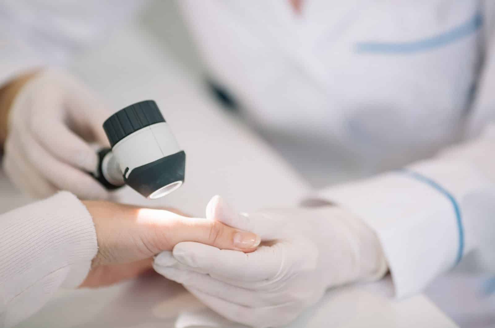 Dermatologo a Padova - unghie