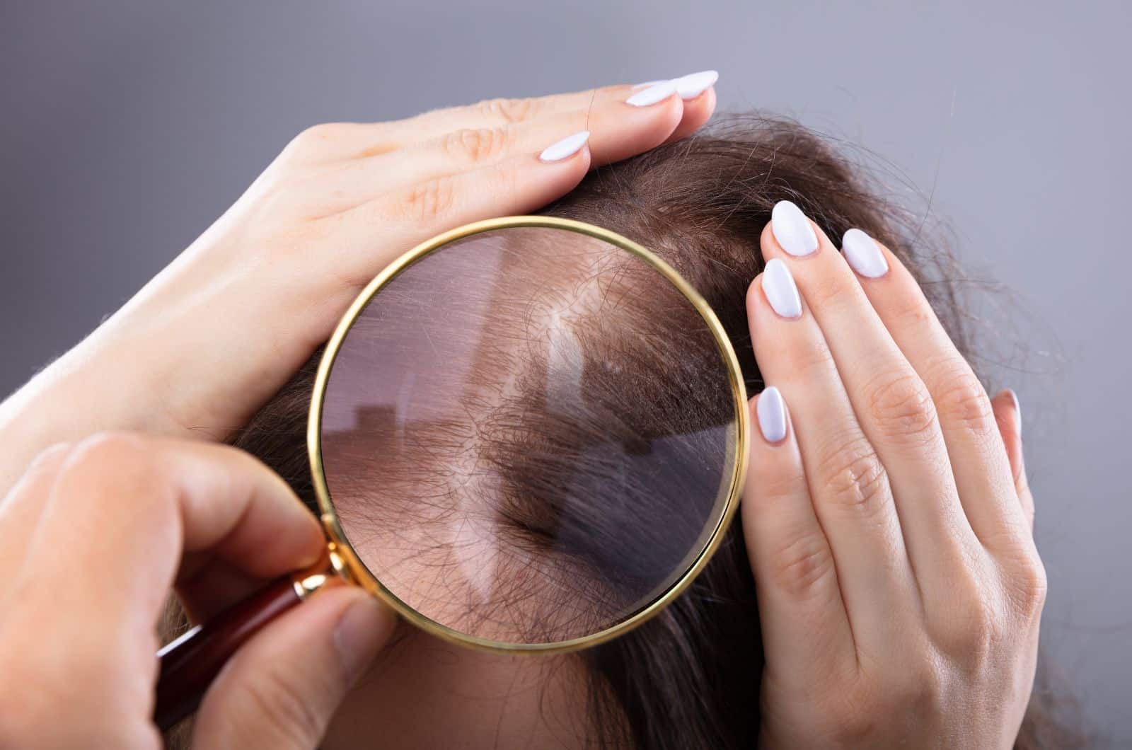 Dermatologo a Padova - capelli