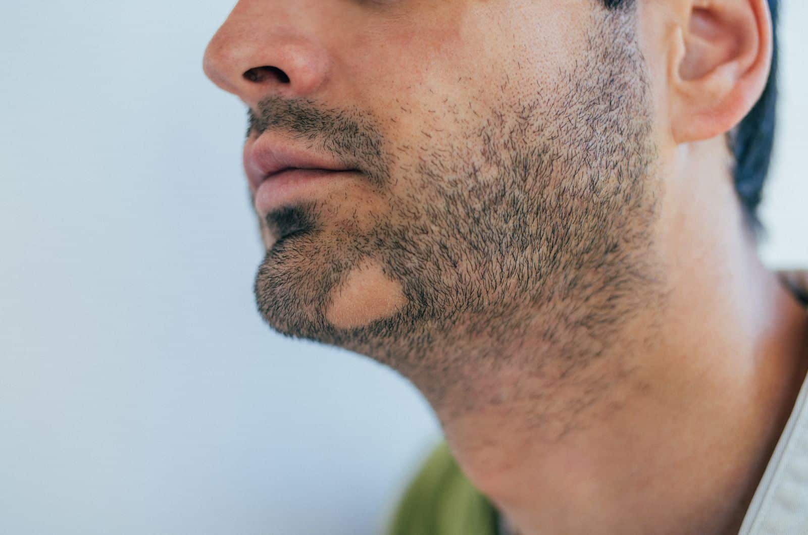 Dermatologo a Padova - pelle
