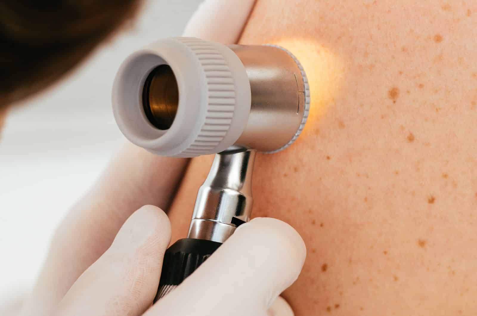 Dermatologo a Padova