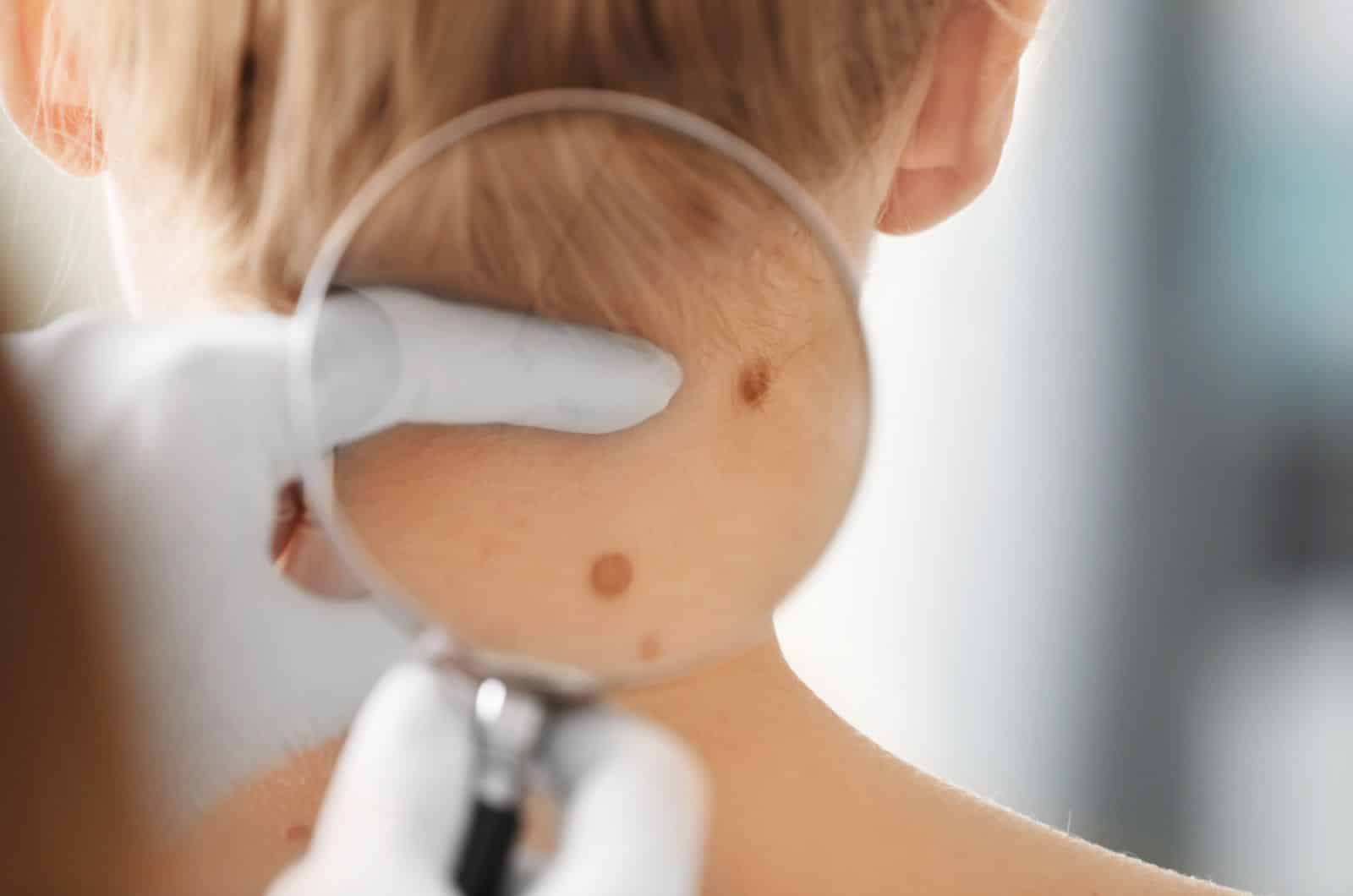 Dermatologo a Padova