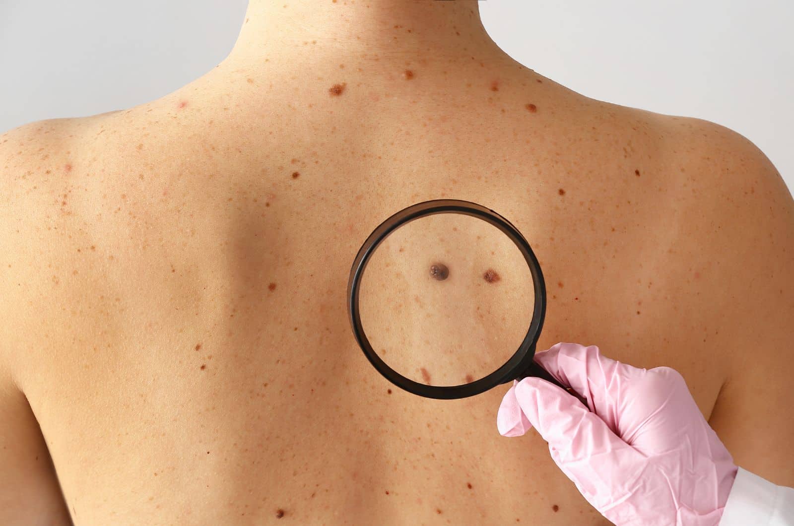 Dermatologo a Padova